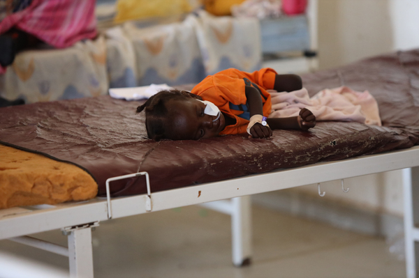 A child is treated for malnutrition at Rifa'a Hospital, in Gezira state, Sudan, on Oct. 9, 2023.