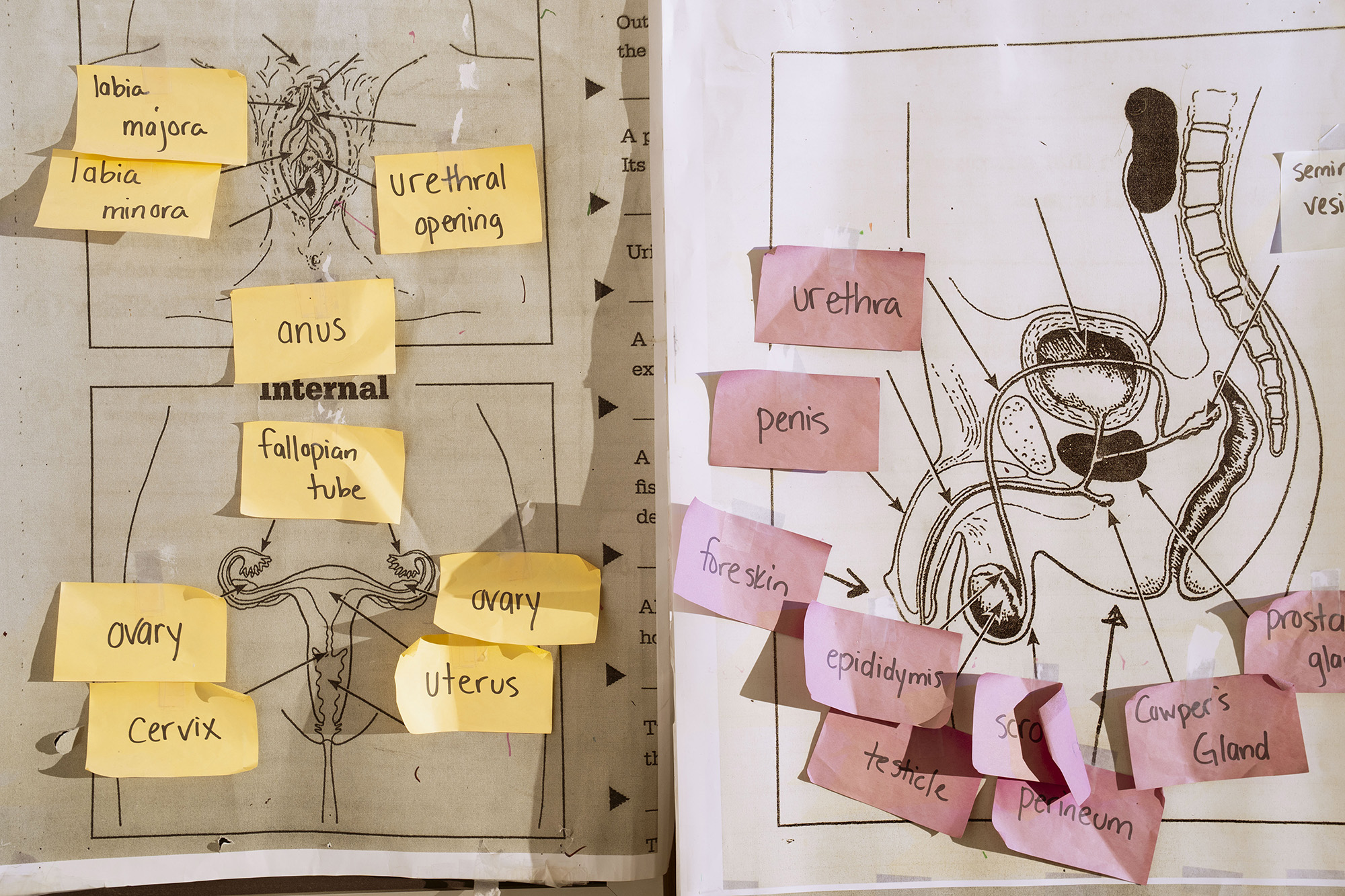 Detail of male and female genitalia with small Post-It Notes labeling body parts.